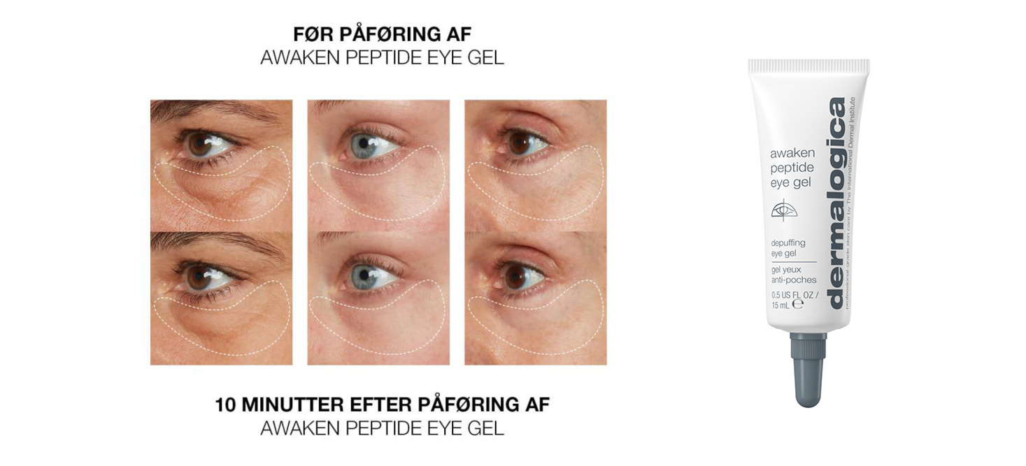 Awaken Peptide Eye Gel - før og efter billeder